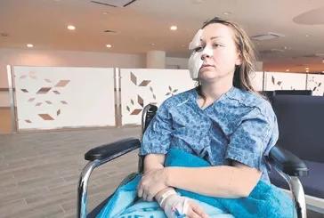 Ukraynalı eşinin yüzünü falçatayla kesmişti! Sanığa tahliye kararı verildi