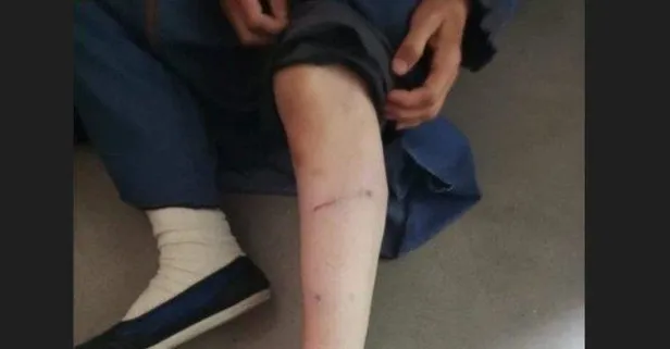 İBB Başkan Danışmanı Murat Ongun'un köpeği Hacer Demirlendi'ye dehşeti yaşatmıştı! Olaya ilişkin soruşturma başlatıldı