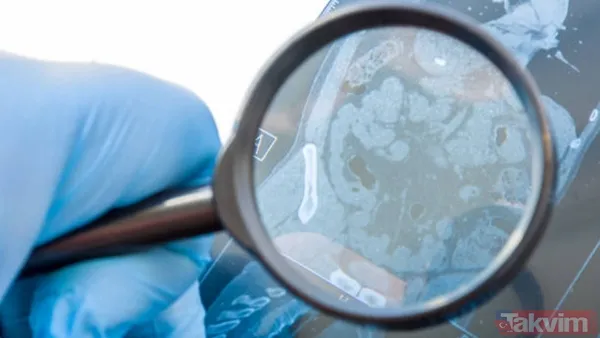 Murat Cemcir’i hastanelik eden sinsi kanama! Uzman: "Çoğu zaman belirti göstermiyor..." - 7