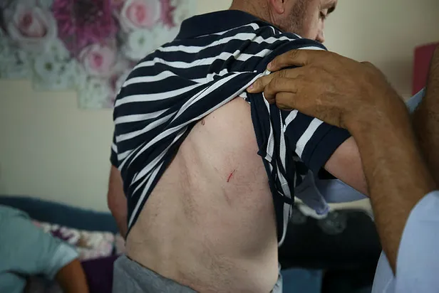 Bursa'da gazinin kafede darbedilmesi ile ilgili yeni gelişme-3