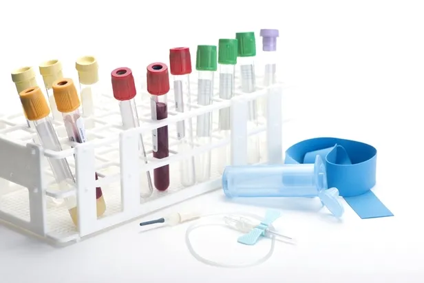 Tahlil yaptırmadan önce dikkat edilmesi gerekenler nelerdir?-1