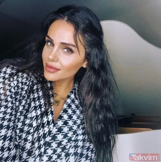 Aleyna Tilki’nin şiş dudakları olay oldu! Son halini gören dönüp bir daha baktı “Ajda Pekkan olma yolunda” - 15