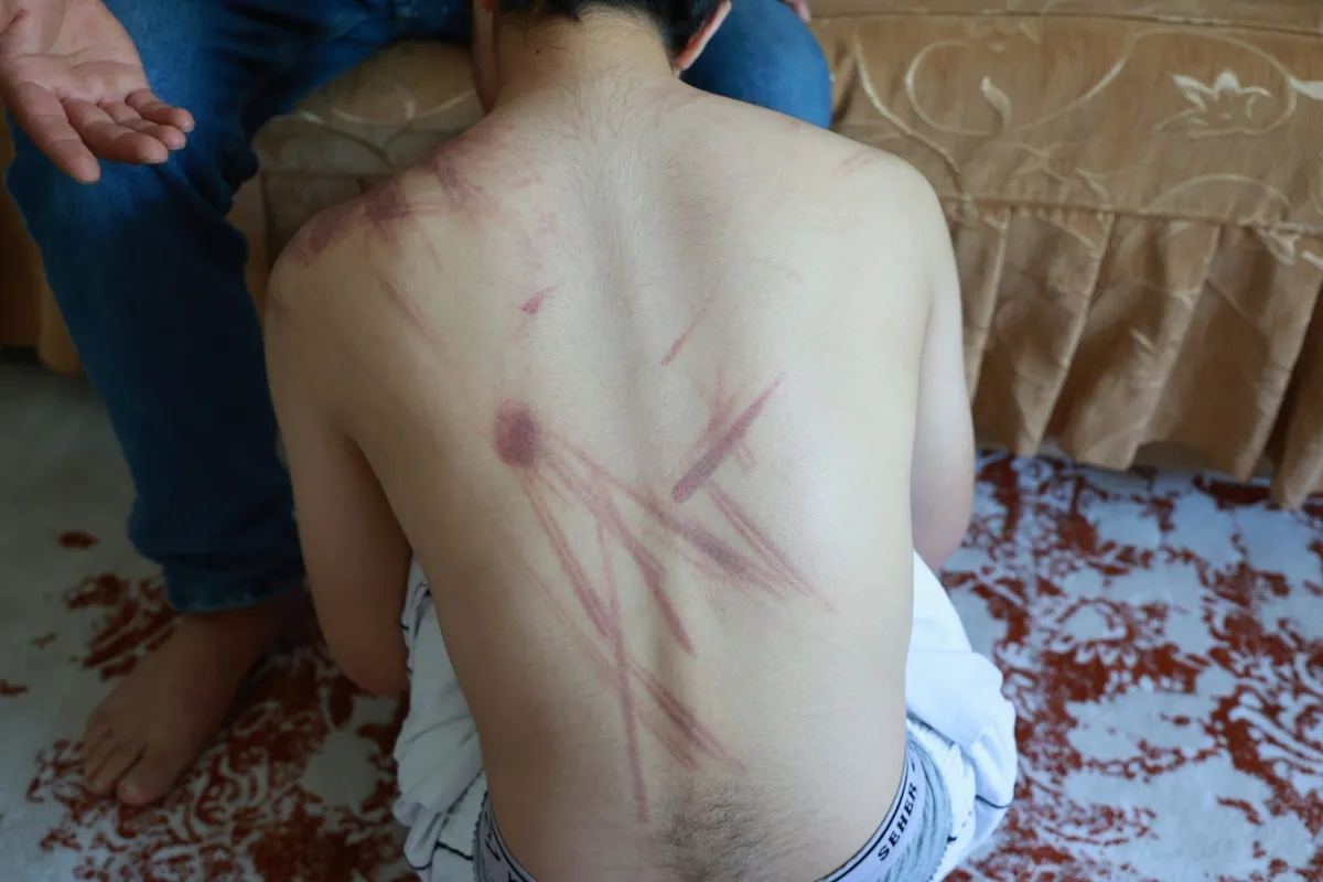 1783849014824.jpeg Elazığ'da down sendromlu çocuğa şiddet iddiası: Baba suç duyurusunda bulundu-3