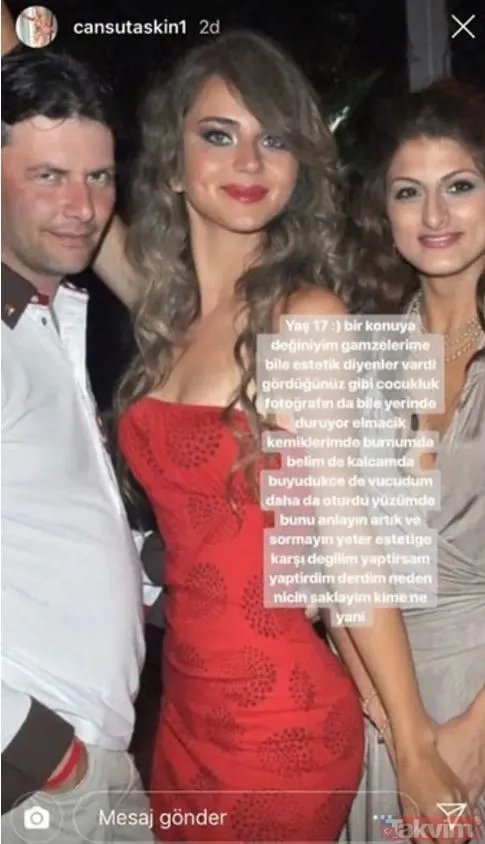 Bana Masal Anlatma’nın Neriman’ı Gökçe Bahadır’n estetiksiz hali çok konuşuldu: “Doğal güzel sanıyordum” - 24