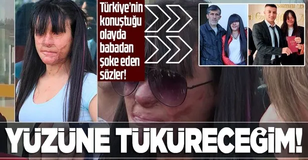 Berfin Özek kendisine asitle saldıran Casim Ozan Çeltik’le neden evlendi? Babası konuştu: Onaylamıyorum