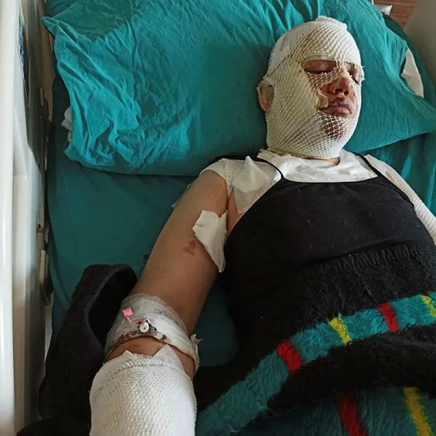 Depremzede eski eşini kaynar suyla yaktı