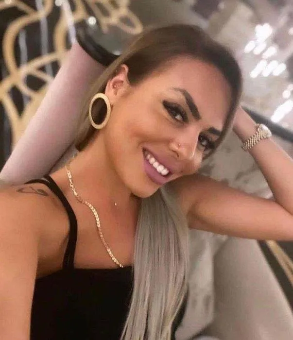 Rezidansta işkence gören Demet A'nın bilirkişi raporu ortaya çıktı! Sigara yanığı, boyun çevresinde ve yüzünde bıçak çizikleri...-3