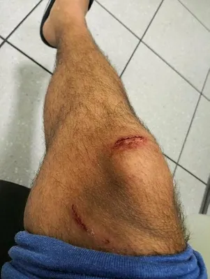 Almanya'da bir Türk'e polis köpeği ile şiddet-5