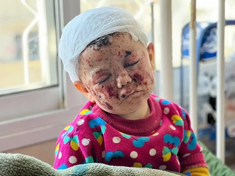 İsrail'in abluka altındaki Gazze Şeridi'ne yönelik saldırıları aralıksız devam ediyor. İsrail'in Gazze kentinin Şeyh Rıdvan Mahallesi'ne düzenlediği saldırılarda sığındıkları ev bombaların hedefi olan Musab el-Hams saldırıda beş kardeşini kaybederken üç kardeşi ve annesi yaralandı. İsrail'in eve düzenlediği saldırı sonucu başı, yüzü, elleri ve ayaklarından ağır yaralanan bebek tedavi altına alındı.