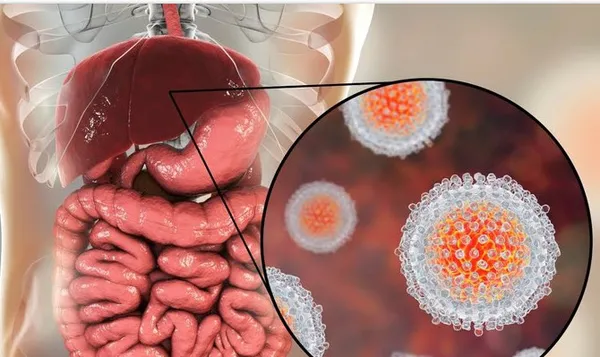 Türkiye’de her 100 kişiden 1’inde var... Hepatit C tarihe karışacak!-4