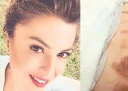 Estetik merkezinde facia! Genç kadının vücudu yandı, iftiraya uğradı!