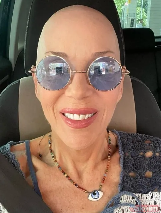 Akciğer kanseri ile mücadele eden Billur Kalkavan son sağlık durumunu merak edenler için paylaştı: "Ciğerimden sular filan alındı..." - 5