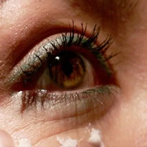 Katarakttan gözünüz kırksun