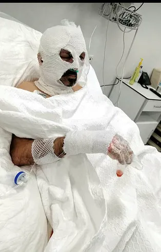 Zonguldak'ta kan donduran vahşet! Tiner döküp diri diri yaktı