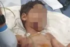 Adana'da 5 yaşındaki çocuk başıboş köpeklerin saldırısına uğradı! Durumu ağır