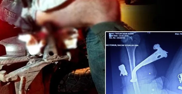 Izmir De Akilalmaz Olay Hastaneye Bu Halde Getirildi Takvim