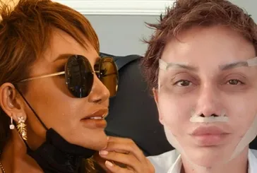 Sünnet derisi enjekte ettiren Seda Sayan’dan sonra... Son haline inanamayacaksınız! Serap Paköz’ün yüzüne ne oldu?