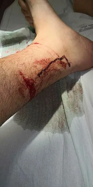 Almanya'da bir Türk'e polis köpeği ile şiddet-3