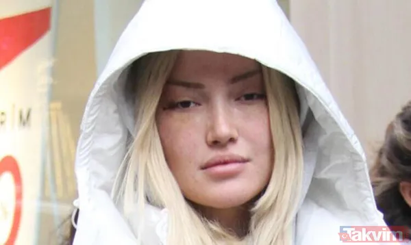 Danla Bilic sonunda bunu da yaptı, estetiğine estetik ekledi! Yüzünde yok yok - 4