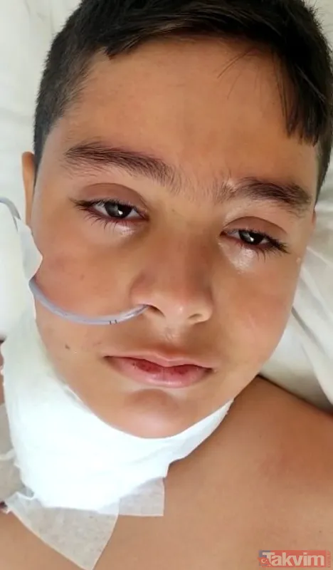 Boğazına demir parmaklık saplanan çocuğun mucize kurtuluşu - 7