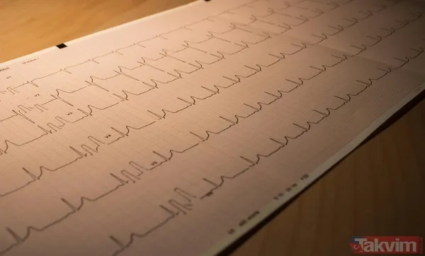 O hastalık kanseri solladı! Meğer Türkiye'de en çok bu hastalık can alıyormuş - 2