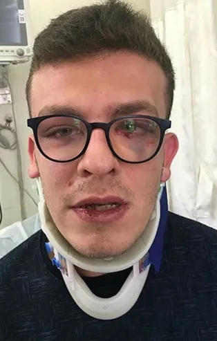 Avcılar'da skandal olay! Taha Alper Behrem isimli otizmli genci öldüresiye dövdü