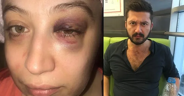 1 aydır evden çıkamıyorum