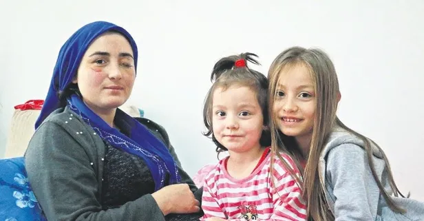 Samsun’da eşinden şiddet gören Elif Kesler: Dünyamı kararttı ışığa hasret kalsın