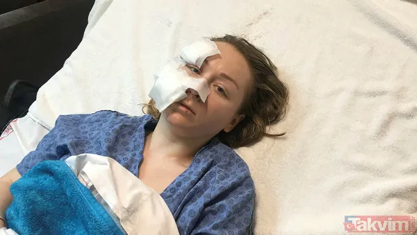 Genç kadına falçatalı dehşet! Boşanmak isteyen Ukraynalı eşi Anna Butim'in yüzünü parçaladı! - 10