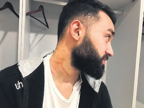 Sakaryasporlu futbolcuları jiletle yaralayan Mansur Çalar serbest bırakıldı-3
