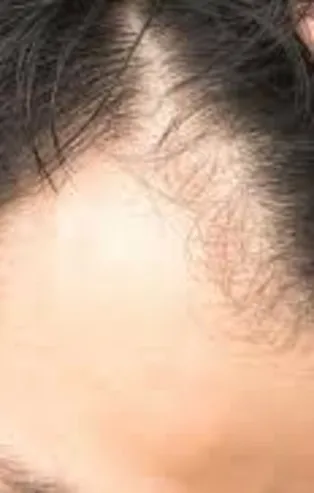 Ne ekonomi ne nükleer program... Güney Kore'de sıra dışı seçim! Sonucu keller belirleyecek