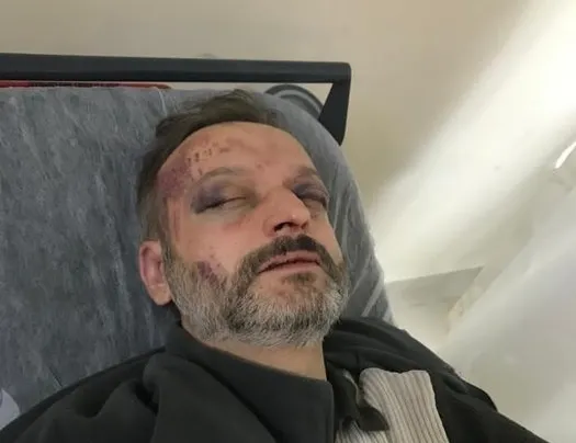 İstek şarkı cinneti: Ölümden döndü