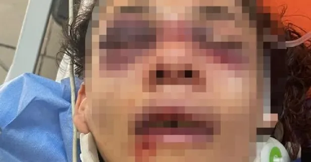 İzmir'de vahşet! 51 yerinden bıçakladı