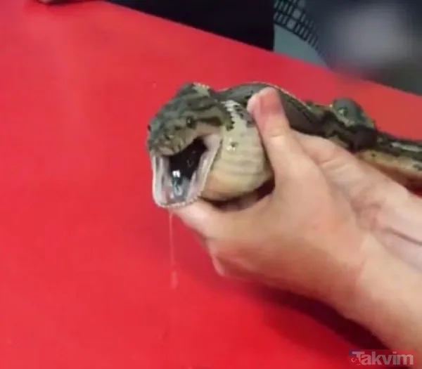 Midesine güvenenler baksın! Kulak ağrısıyla hastaneye giden adamın kulağından çıkanlar dünyayı şoke etti - 36