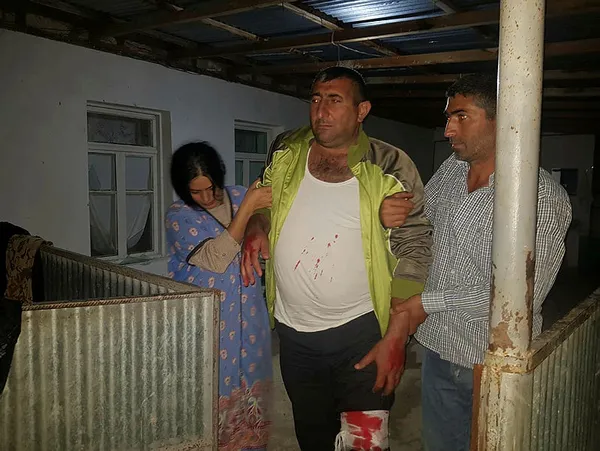 ermenistan-azerbaycan-halkini-bombaladi-iste-yarali-kardeslerimiz-1601218352387.jpg Ermenistan Azerbaycan halkını bombaladı! İşte yaralı kardeşlerimiz...-5