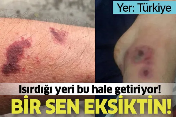 O ilde büyük panik! Isırdığı yeri çürütüyor! 'Asya Kaplanı' denilen...-1