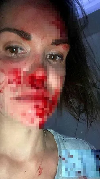 SON DAKİKA Lüks sitede ölü bulunan Rus kadınla ilgili flaş gelişme! Kameralar incelendi: Sır perdesi aralanıyor-3