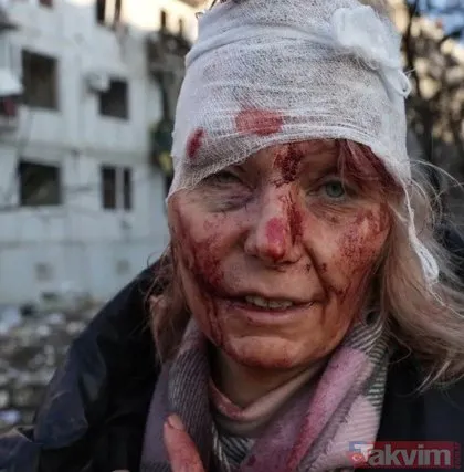 SON DAKİKA: Rusya Ukrayna savaşında son durum! Simge isim Olena Kurilo konuştu: Hayatta kalmamı sağlayan bir meleğim olmalı