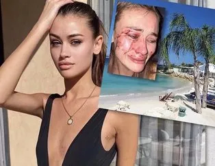 Ukraynalı modelin dövüldüğü Momo Beach kapatıldı