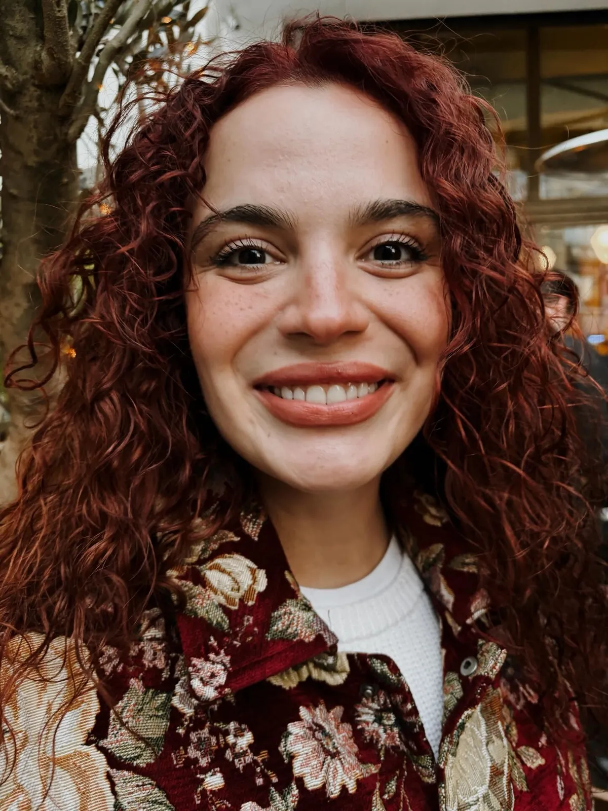 7-kez-ameliyat-olan-asli-bekiroglundan-kotu-haber-kaslari-yirtildi-1780735870237.jpg Miyom ameliyatında bağırsağı kesilmişti... Aslı Bekiroğlu taburcu olur olmaz hastanelik oldu! "Herkesin bir sınırı var"-2