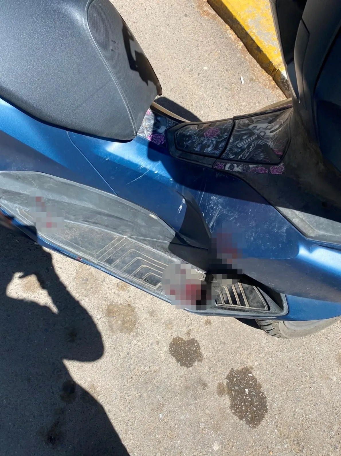 1785673966577.jpeg Antalya'da sipariş almaya giden motokuryeye döner bıçaklı saldırı: İki parmağı kopma noktasına geldi-5