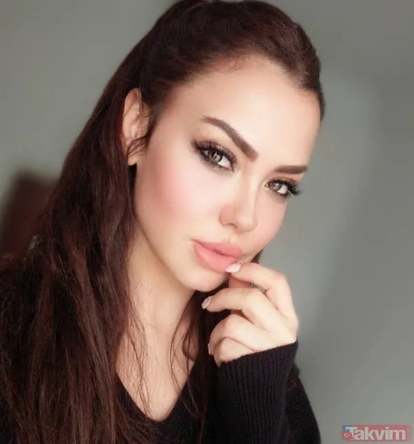 Şarkıcı Lara sonunda küçülttü! Estetikle bambaşka biri olan Lara paylaştı görenler 'yok artık' dedi - 2