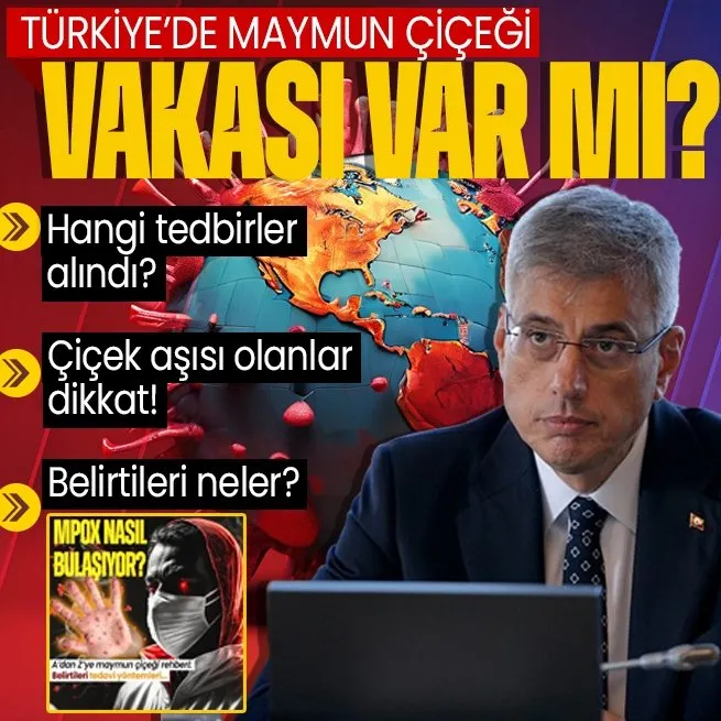 Sağlık Bakanı Kemal Memişoğlu’ndan flaş açıklamalar! Türkiye’de maymun çiçeği vakası var mı? Vatandaşlar hangi tedbirleri almalı?