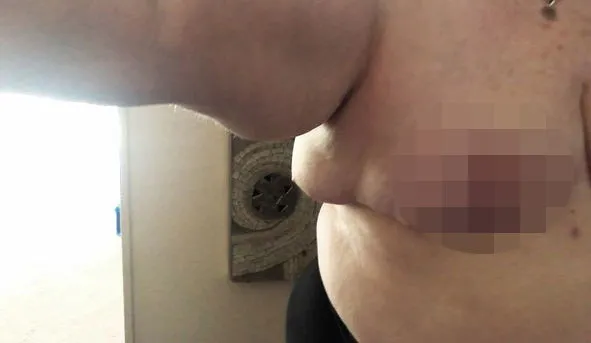 Göğsünü küçültmek için gitti! Üçüncü göğsü çıktı-3