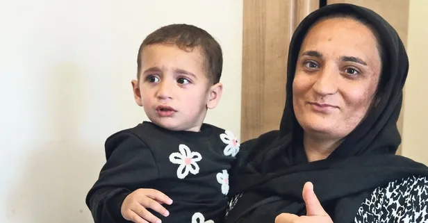 İşitme engelli ailenin bebeğine biyonik kulak ameliyatı: İlk kez sesleri duydu