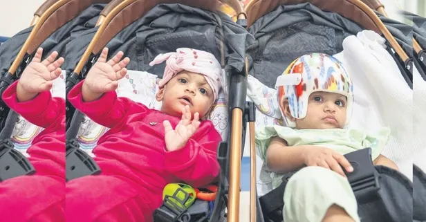 Pakistanlı yapışık ikizler için Türkiye'de 14 saatlik operasyon! Emine Erdoğan kahraman doktorları tebrik etti