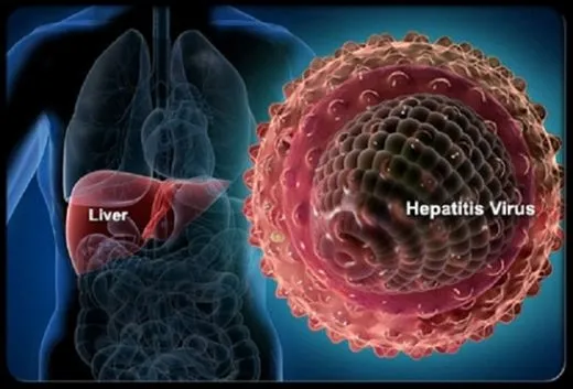 Korkunç gerçek ortaya çıktı: 10 kişiden 9'u hepatit hastası olduğundan habersiz!-1