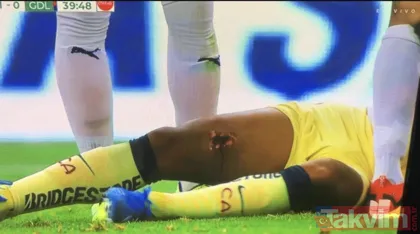 Galatasaraylı eski yıldız korkunç bir şekilde sakatlandı! Bacağına krampon girdi