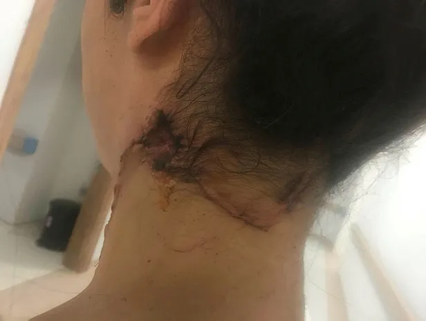 Antalya'da eski eş vahşetinden kurtulan Oya Aydoğdu: Aklıma Emine Bulut geldi-5