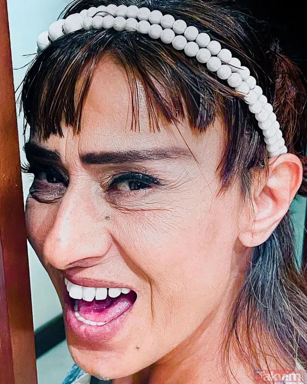 Yıldız Tilbe'nin son halini görenler gözlerine inanamadı "Kısa oluverdi iyi oldu" Sahnede kıyafeti düşen Yıldız Tilbe... - 2